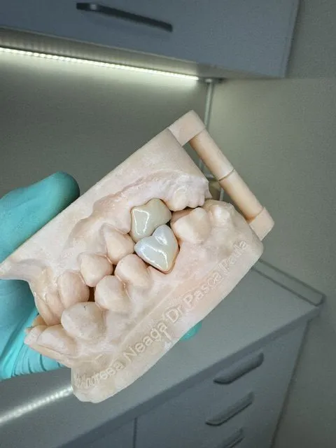 Model dentar pentru planificarea lucrării
